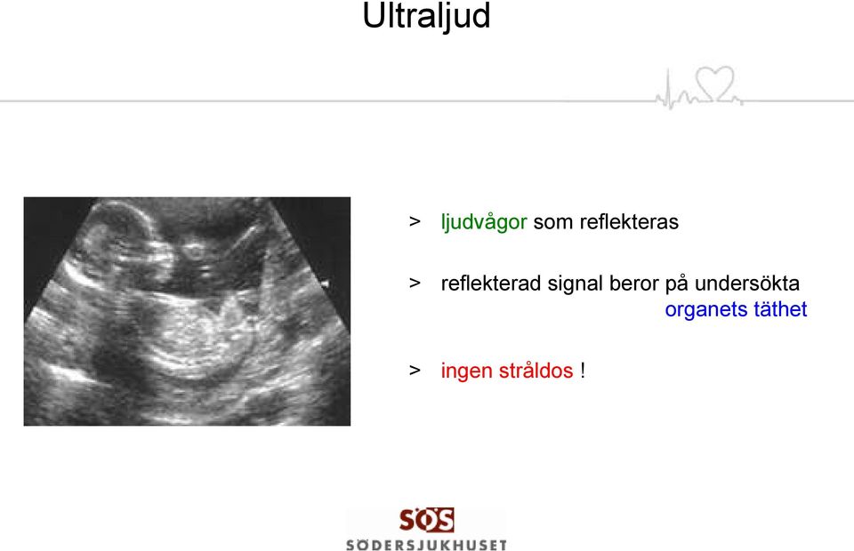 signal beror på undersökta