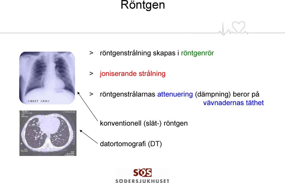 attenuering (dämpning) beror på vävnadernas