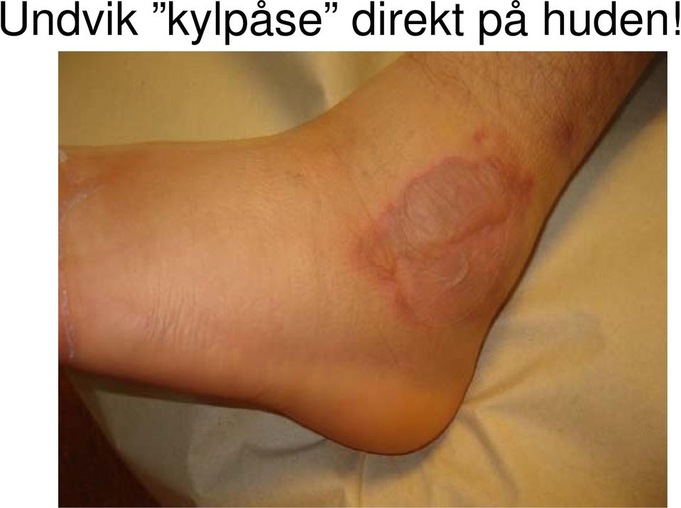 direkt på