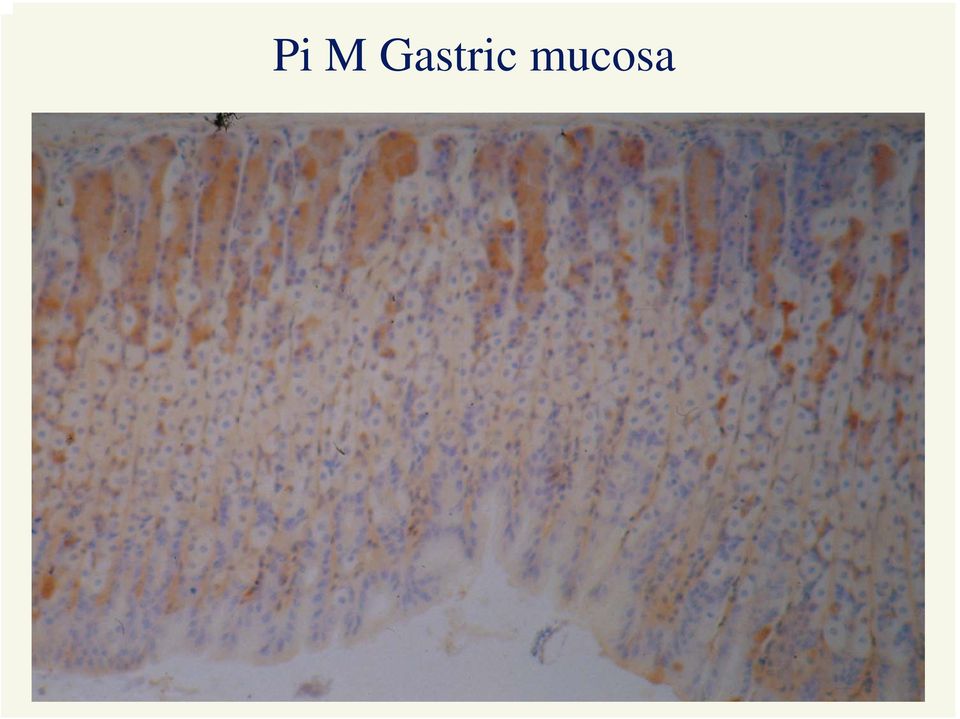 mucosa