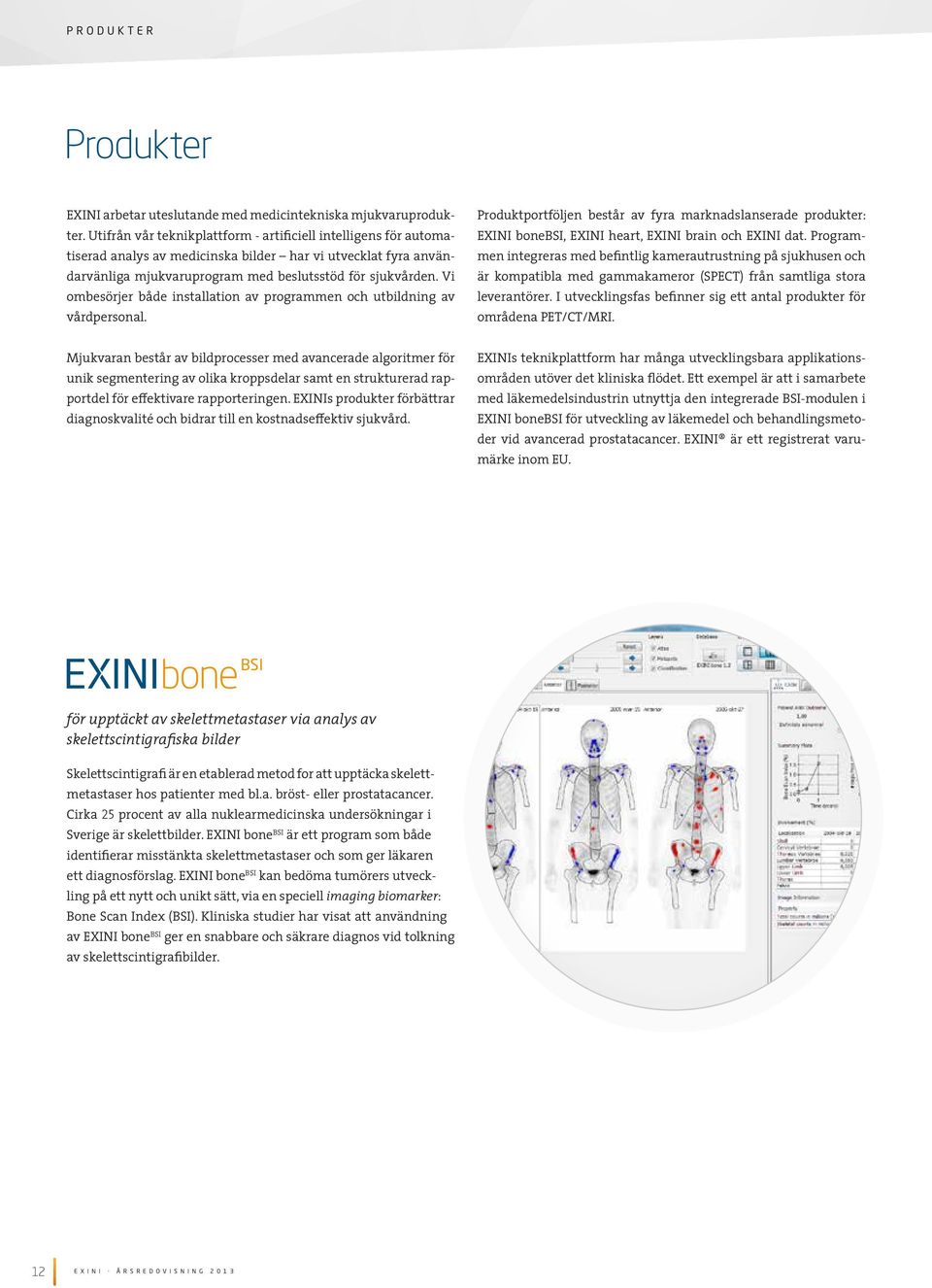 Vi ombesörjer både installation av programmen och utbildning av vårdpersonal. Produktportföljen består av fyra marknadslanserade produkter: EXINI bonebsi, EXINI heart, EXINI brain och EXINI dat.