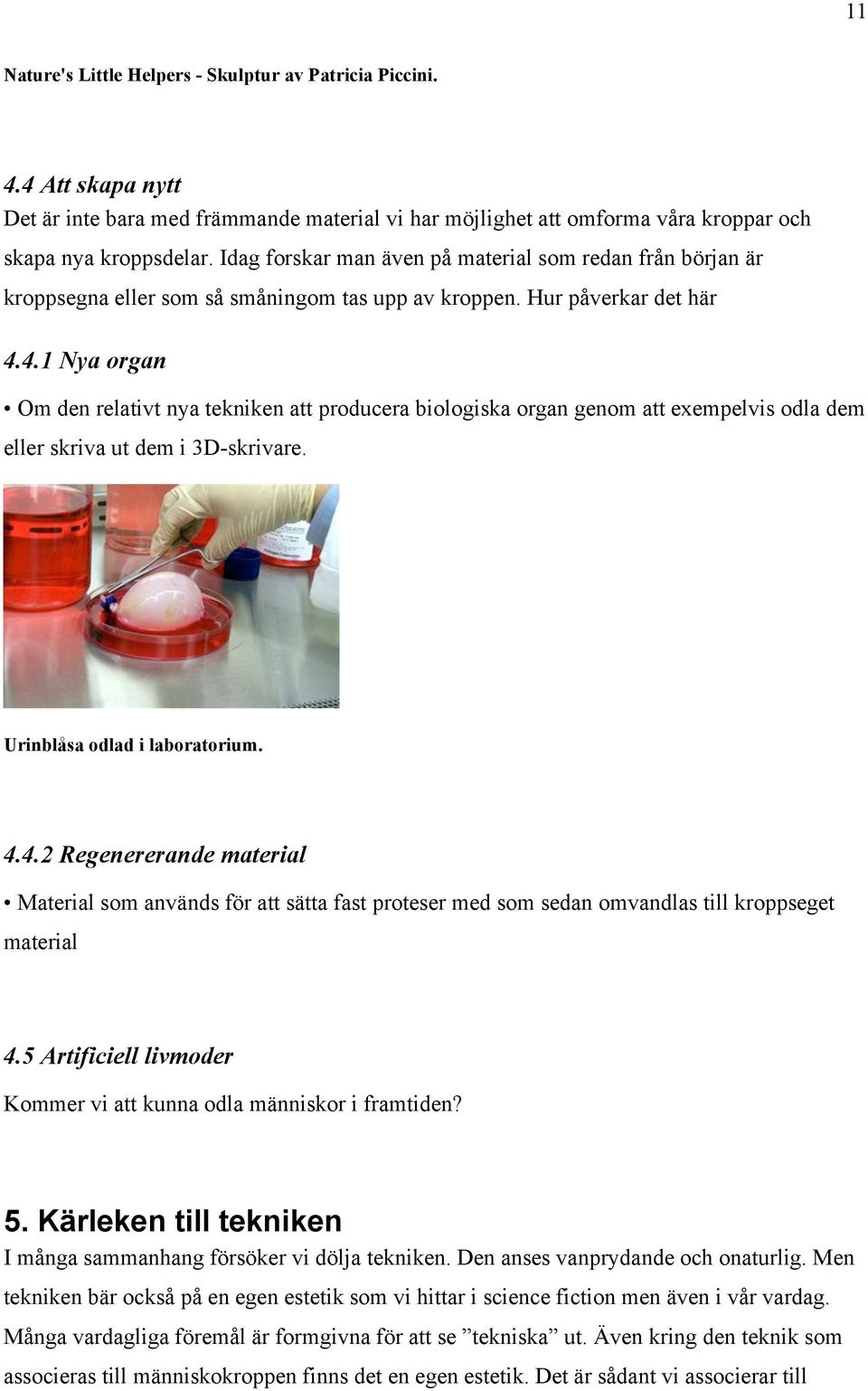 4.1 Nya organ Om den relativt nya tekniken att producera biologiska organ genom att exempelvis odla dem eller skriva ut dem i 3D-skrivare. Urinblåsa odlad i laboratorium. 4.4.2 Regenererande material Material som används för att sätta fast proteser med som sedan omvandlas till kroppseget material 4.