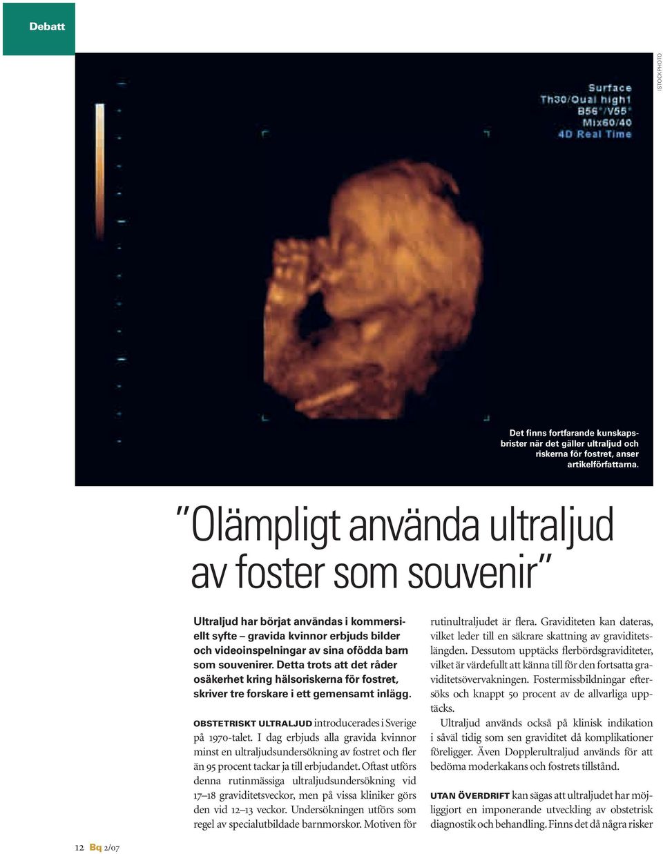 Detta trots att det råder osäkerhet kring hälsoriskerna för fostret, skriver tre forskare i ett gemensamt inlägg. OBSTETRISKT ULTRALJUD introducerades i Sverige på 1970-talet.