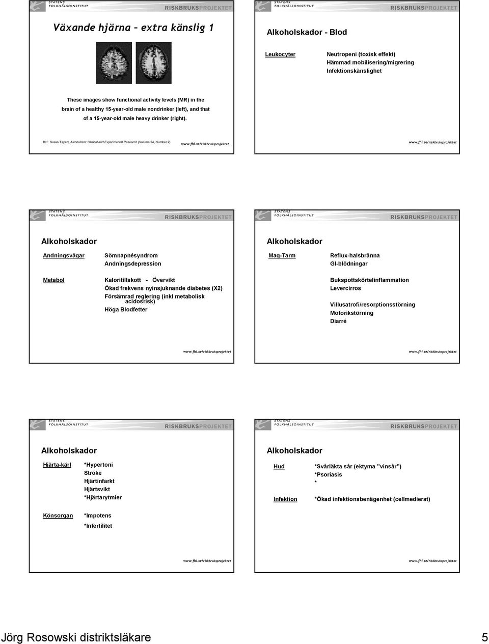 Ref: Susan Tapert, Alcoholism: Clinical and Experimental Research (Volume 24, Number 2) Alkoholskador Alkoholskador Andningsvägar Sömnapnésyndrom Andningsdepression Mag-Tarm Reflux-halsbränna