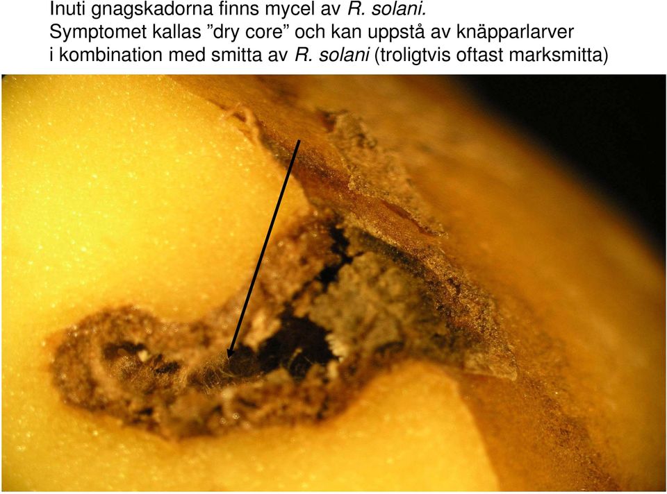 Symptomet kallas dry core och kan uppstå