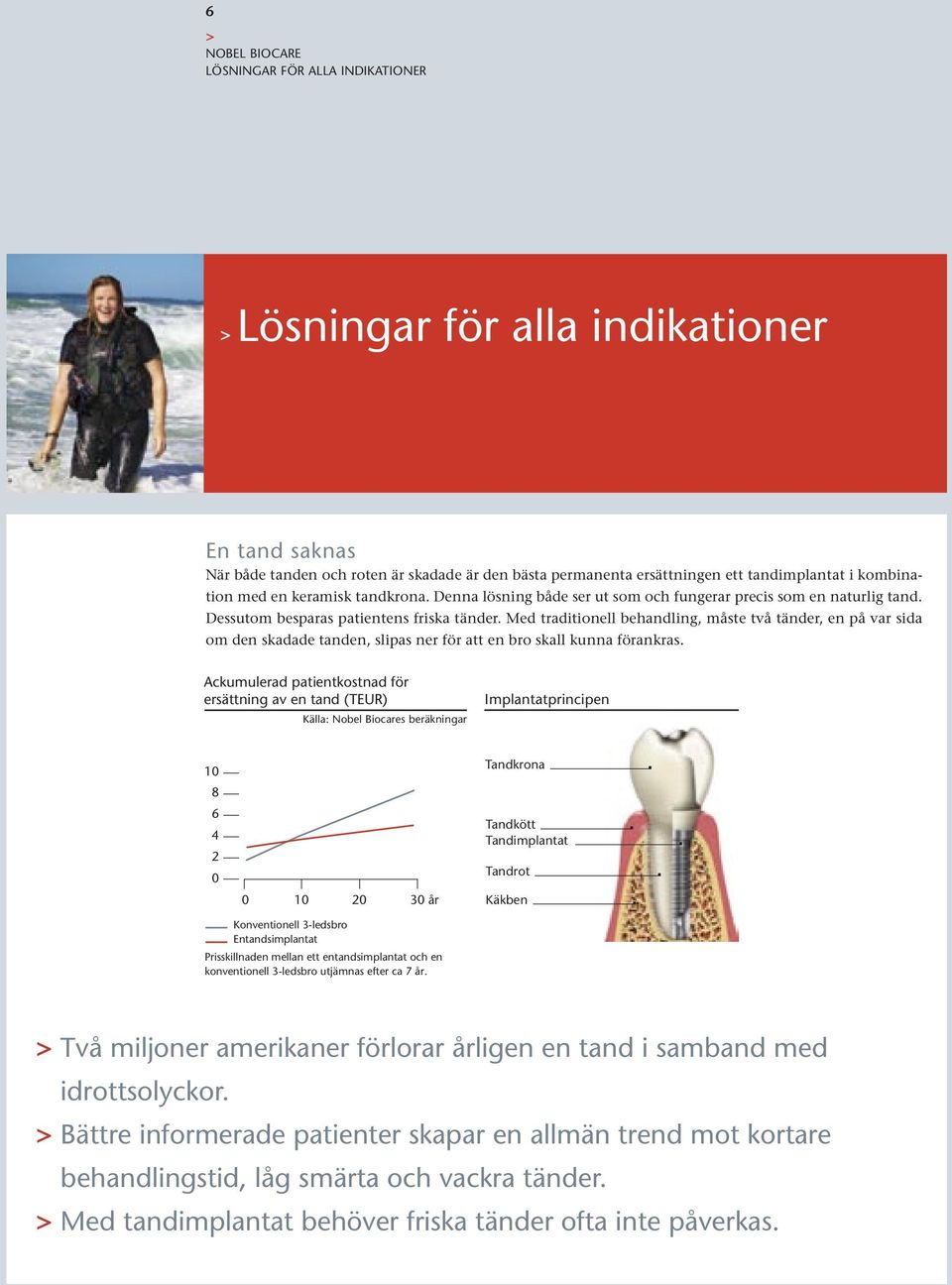 Med traditionell behandling, måste två tänder, en på var sida om den skadade tanden, slipas ner för att en bro skall kunna förankras.