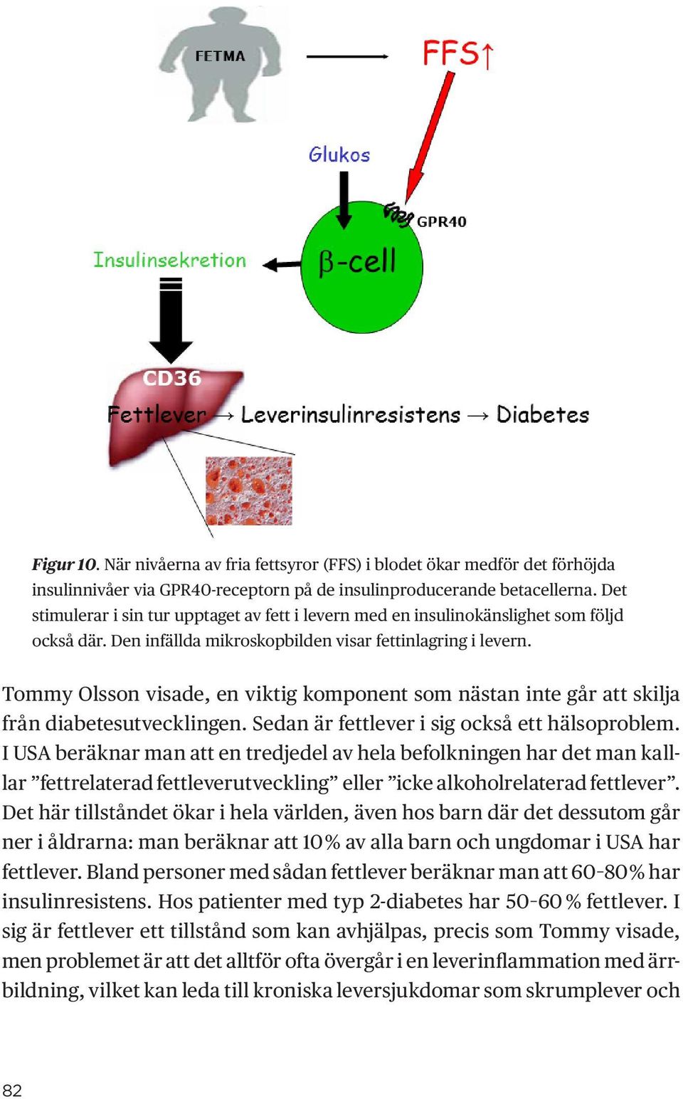 Tommy Olsson visade, en viktig komponent som nästan inte går att skilja från diabetesutvecklingen. Sedan är fettlever i sig också ett hälsoproblem.