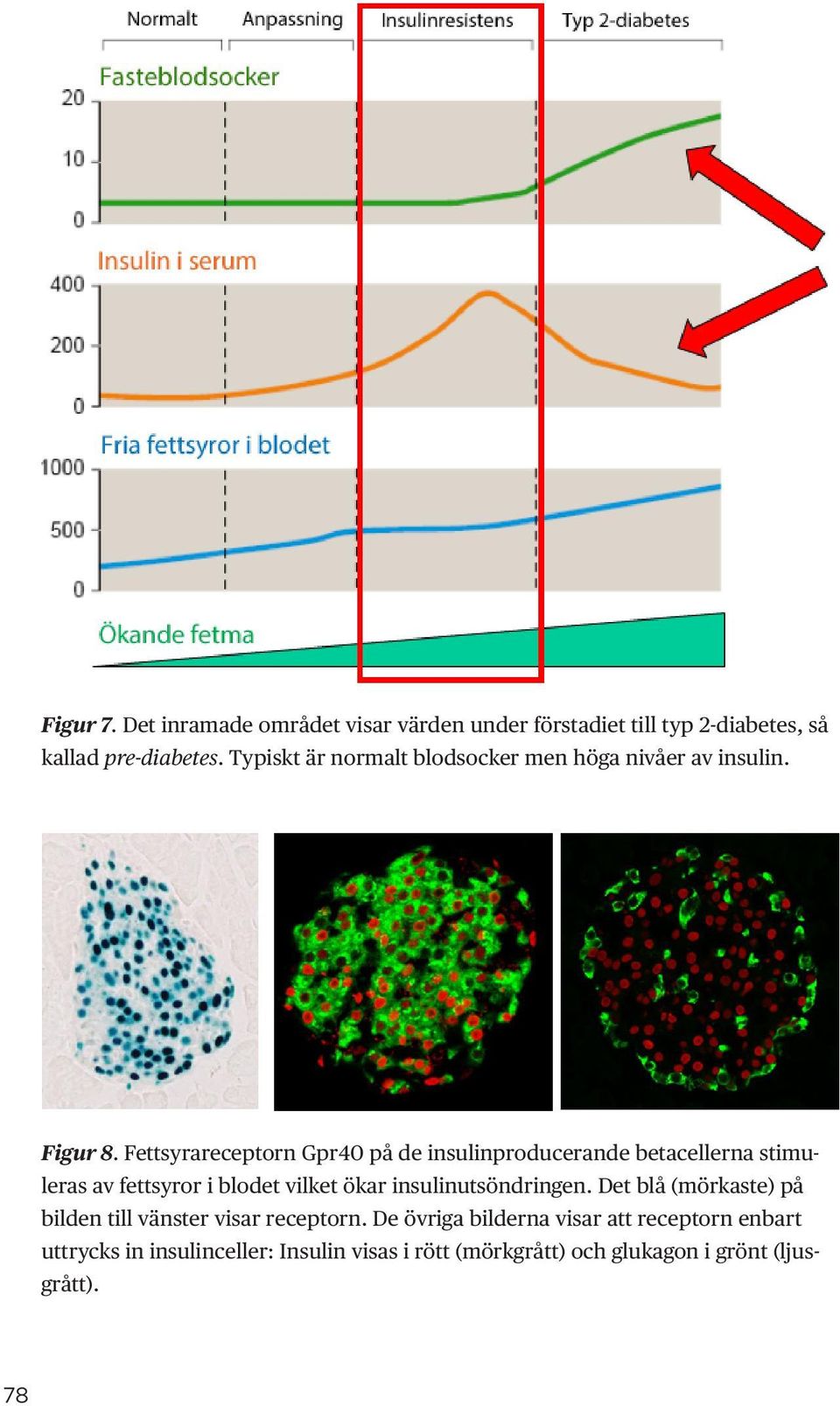 Fettsyrareceptorn Gpr40 på de insulinproducerande betacellerna stimuleras av fettsyror i blodet vilket ökar