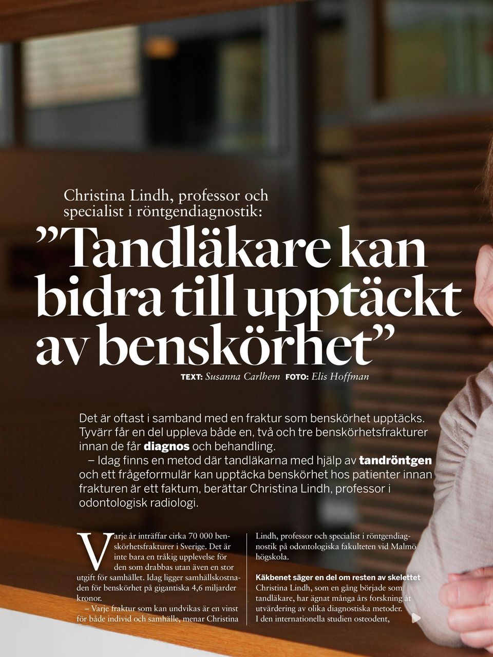 Idag finns en metod där tandläkarna med hjälp av tandröntgen och ett frågeformulär kan upptäcka benskörhet hos patienter innan frakturen är ett faktum, berättar Christina Lindh, professor i