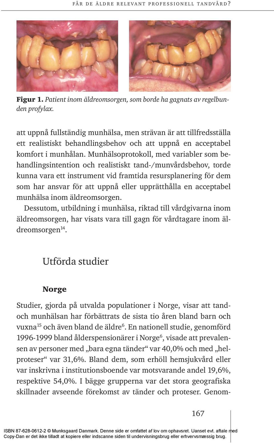 Munhälsoprotokoll, med variabler som behandlingsintention och realistiskt tand-/munvårdsbehov, torde kunna vara ett instrument vid framtida resursplanering för dem som har ansvar för att uppnå eller