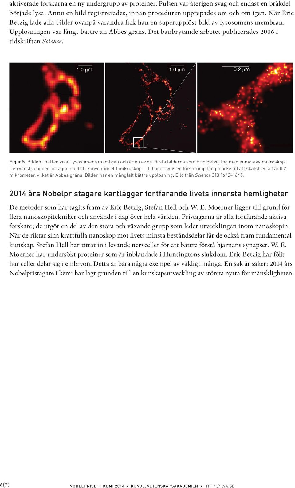 Det banbrytande arbetet publicerades 2006 i tidskriften Science. Figur 5. Bilden i mitten visar lysosomens membran och är en av de första bilderna som Eric Betzig tog med enmolekylmikroskopi.