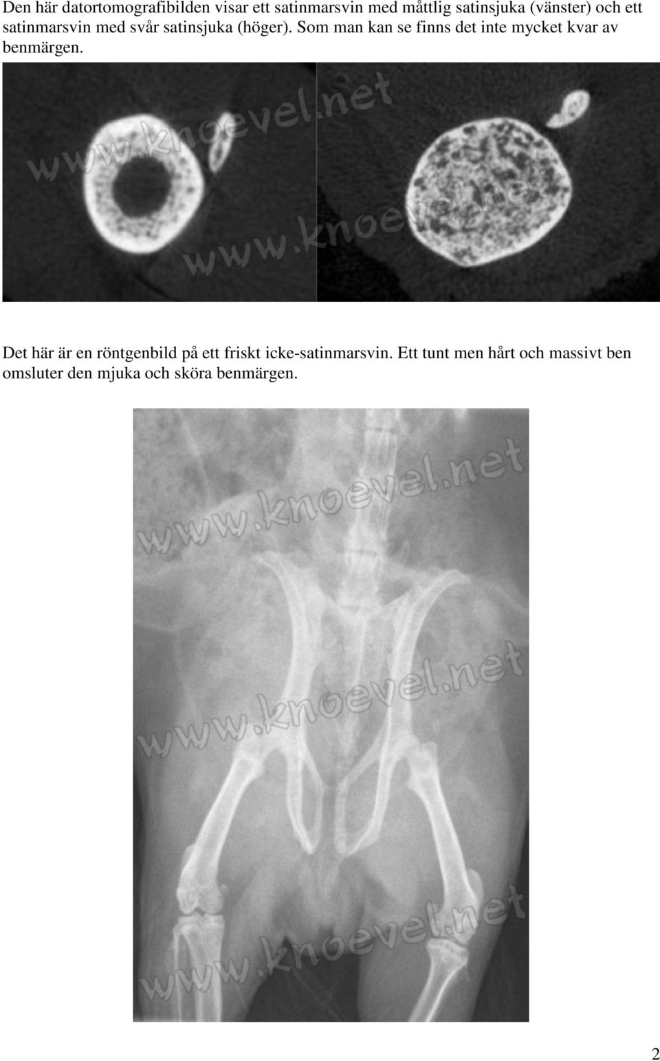 Som man kan se finns det inte mycket kvar av benmärgen.