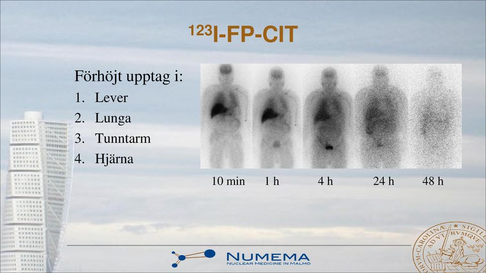 Lunga 3. Tunntarm 4.