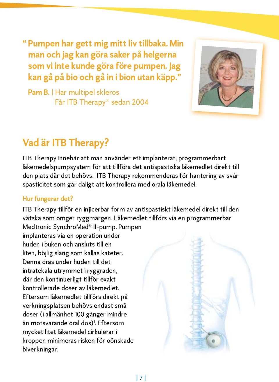 ITB Therapy innebär att man använder ett implanterat, programmerbart läkemedelspumpsystem för att tillföra det antispastiska läkemedlet direkt till den plats där det behövs.