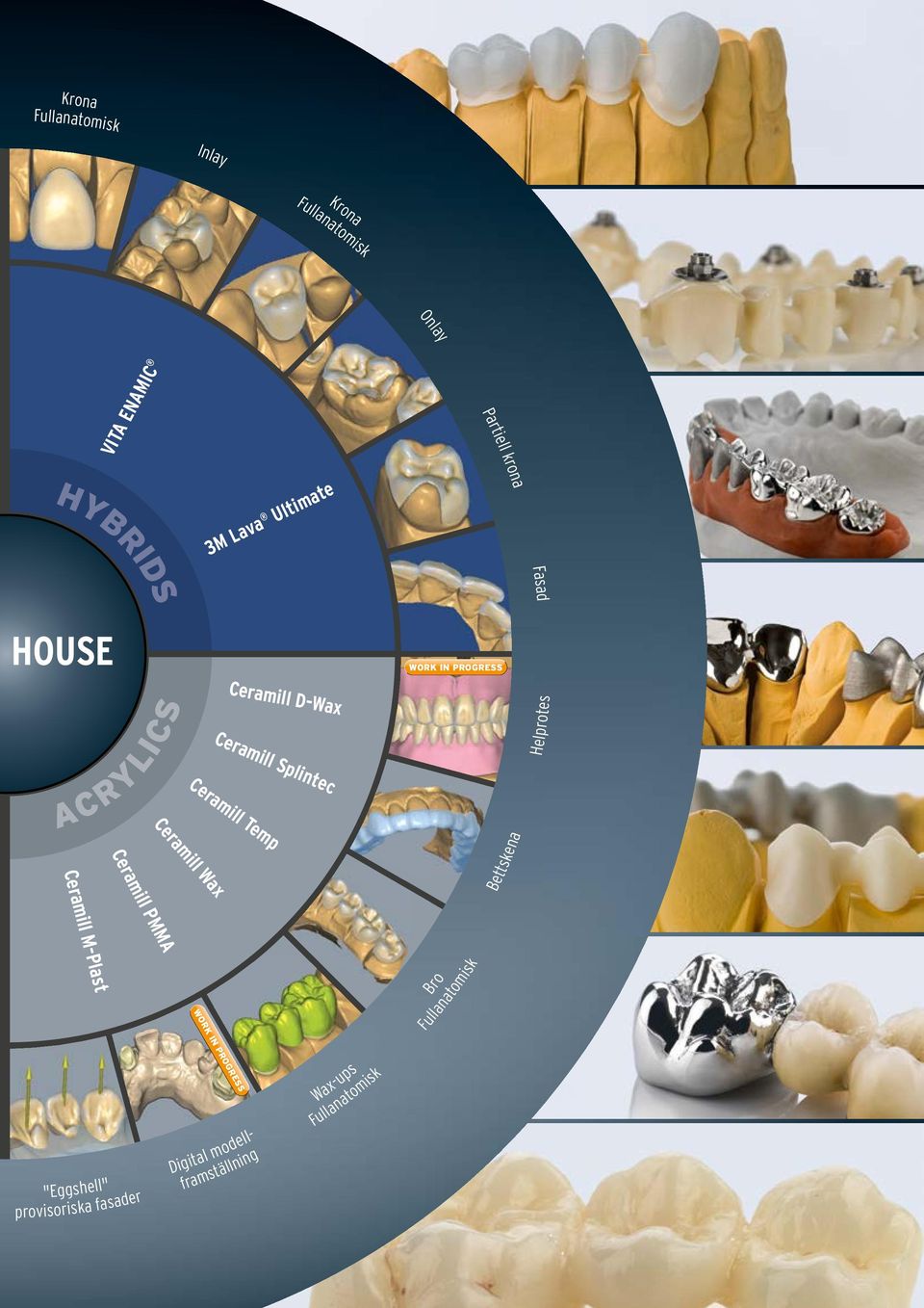 Splintec Ceramill Temp Bettskena Helprotes Ceramill PMMA Ceramill M-Plast Bro Fullanatomisk