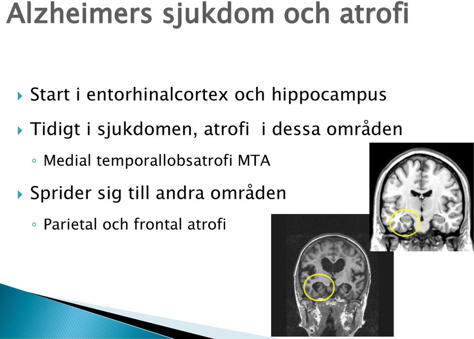 sjukdomen, atrofi i dessa områden Medial