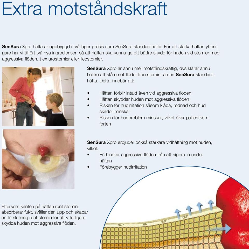 SenSura Xpro är ännu mer motståndskraftig, dvs klarar ännu bättre att stå emot flödet från stomin, än en SenSura standardhäfta.