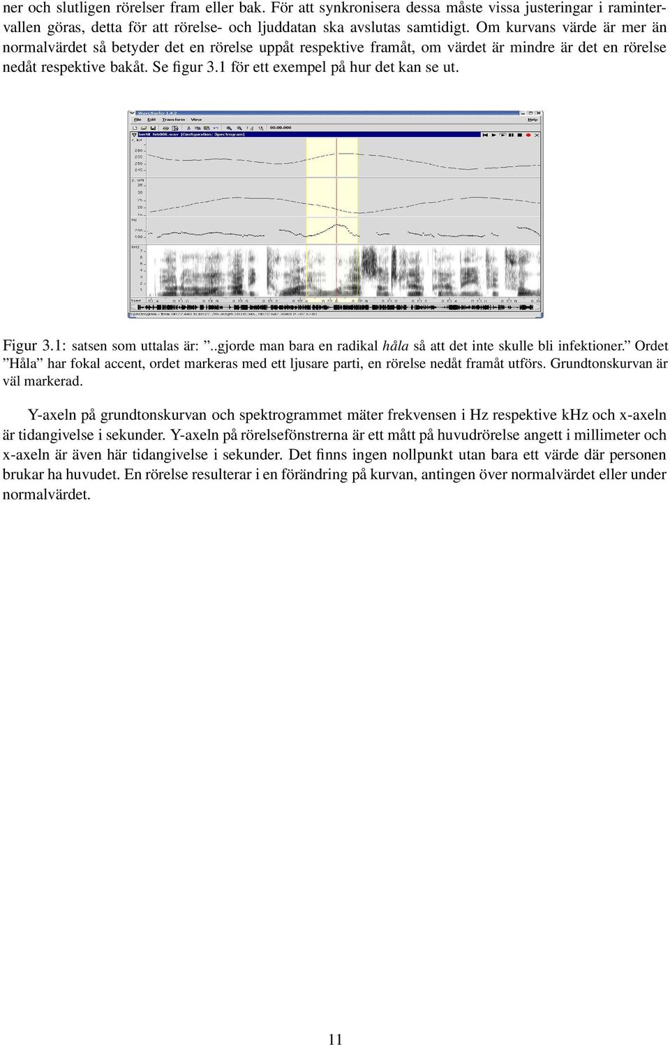 1 för ett exempel på hur det kan se ut. Figur 3.1: satsen som uttalas är:..gjorde man bara en radikal håla så att det inte skulle bli infektioner.