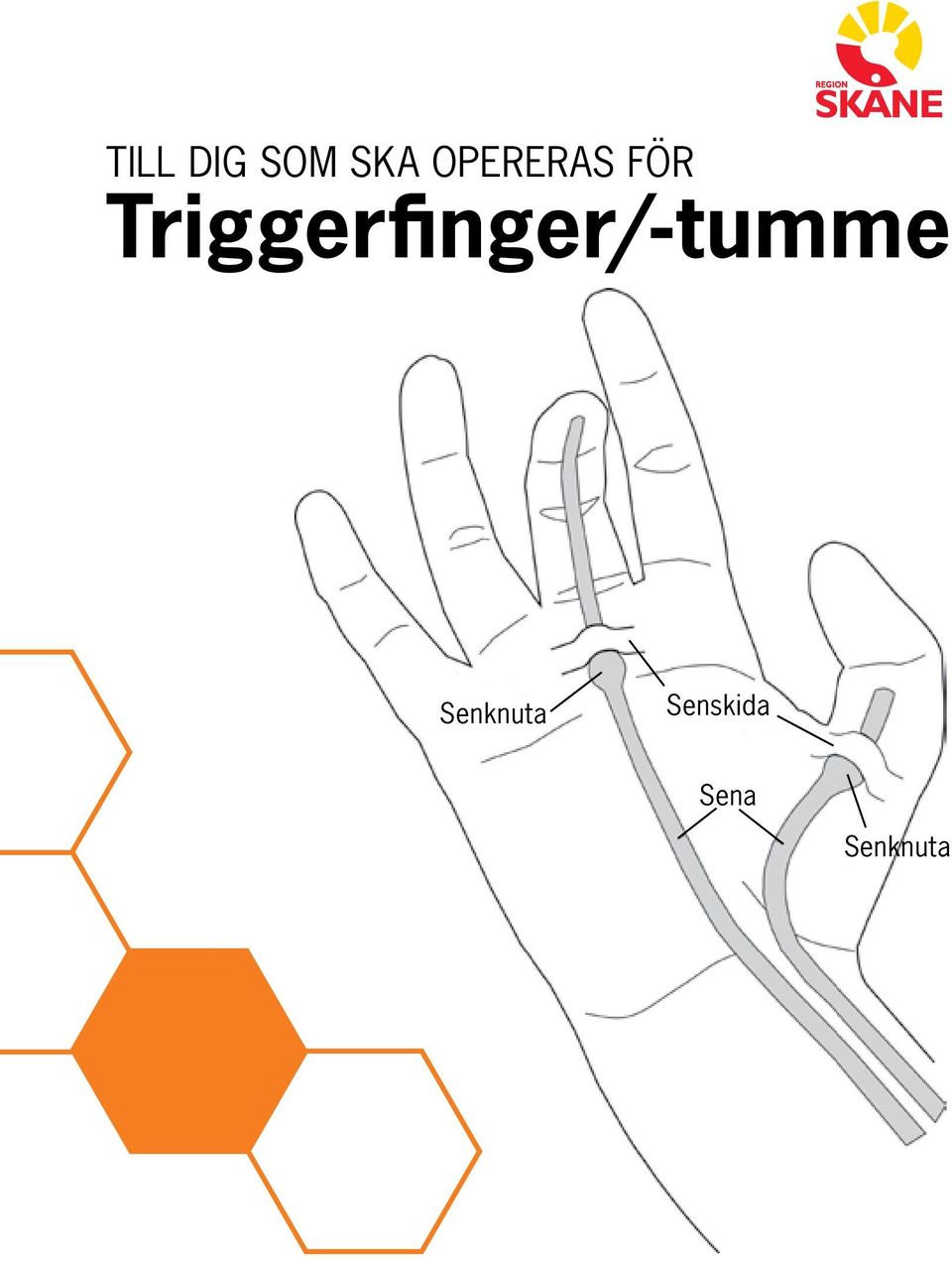 Triggerfinger/-tumme