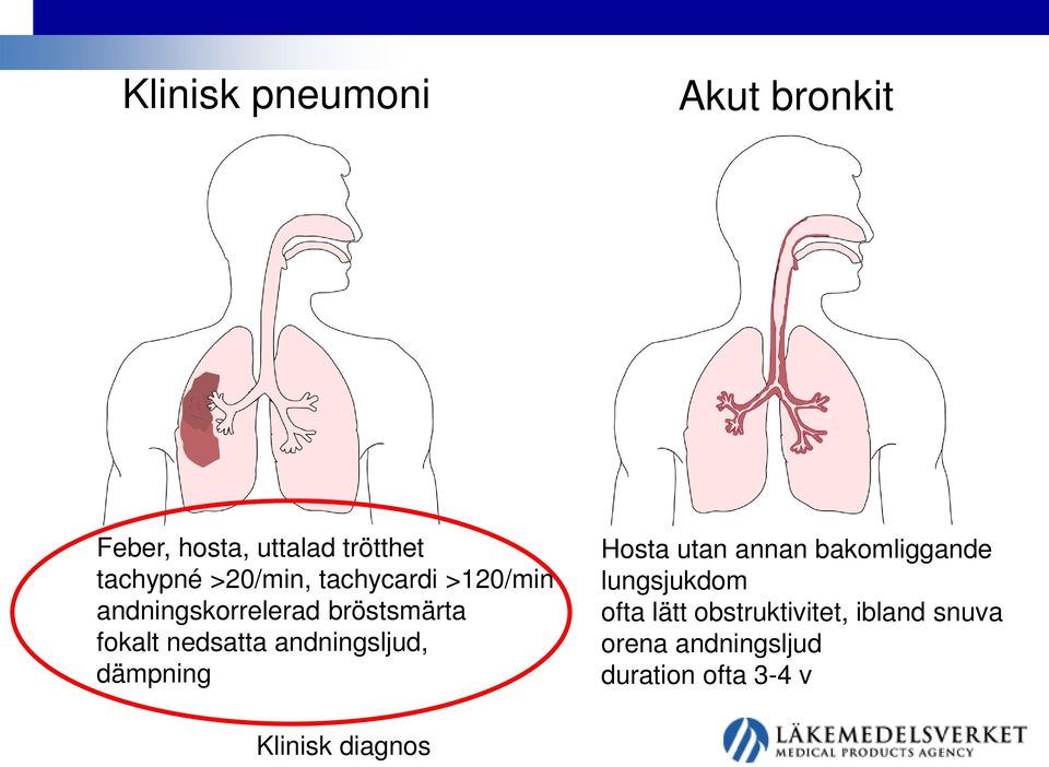 andningsljud, dämpning Hosta utan annan bakomliggande lungsjukdom ofta lätt