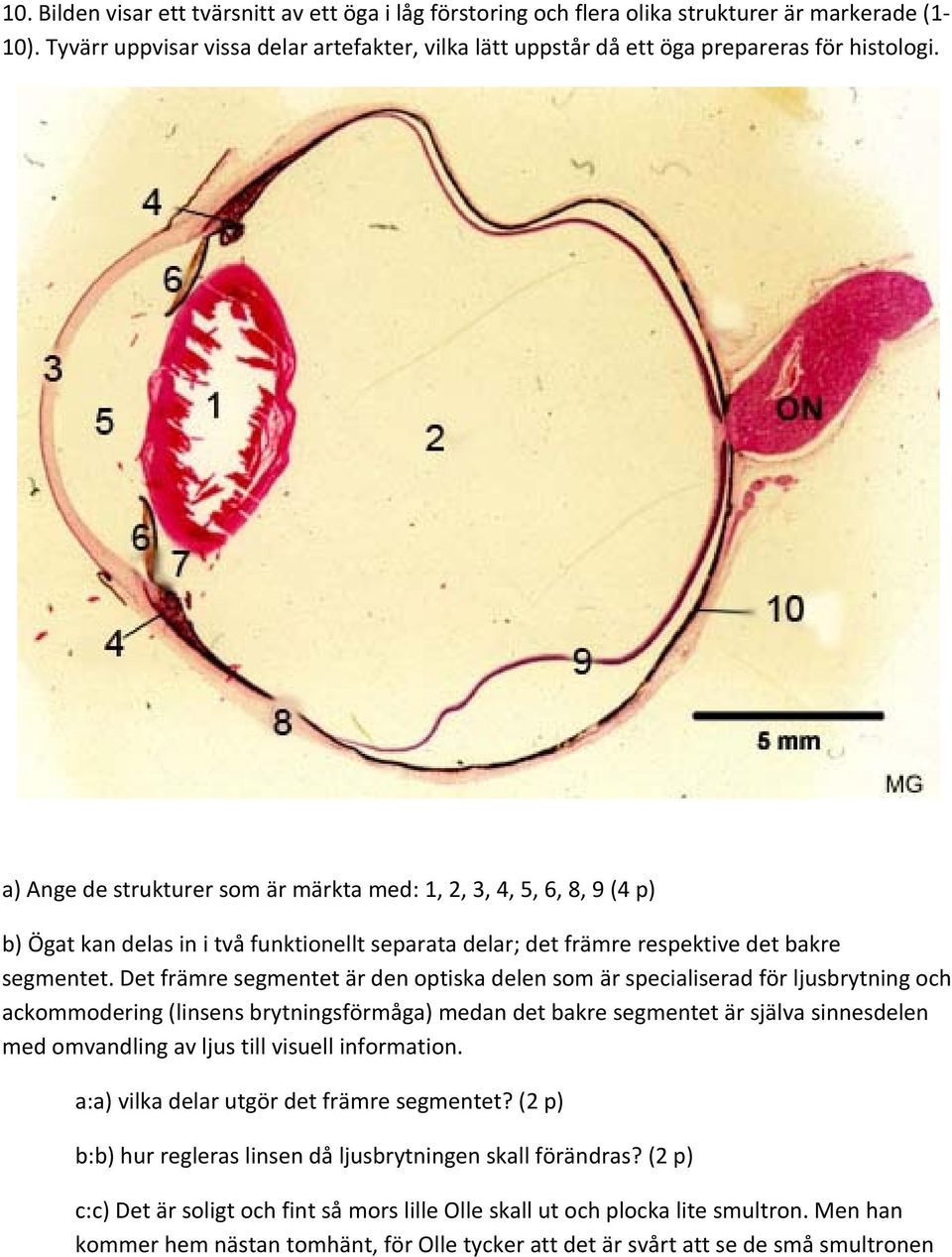 a) Ange de strukturer som är märkta med: 1, 2, 3, 4, 5, 6, 8, 9 (4 p) b) Ögat kan delas in i två funktionellt separata delar; det främre respektive det bakre segmentet.