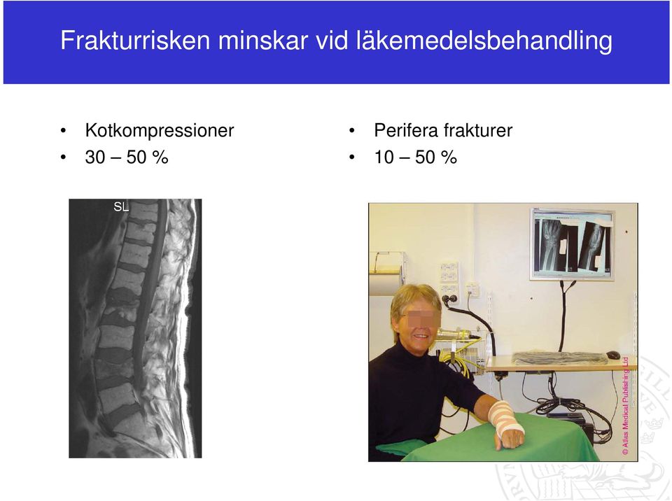 Kotkompressioner 30 50 %