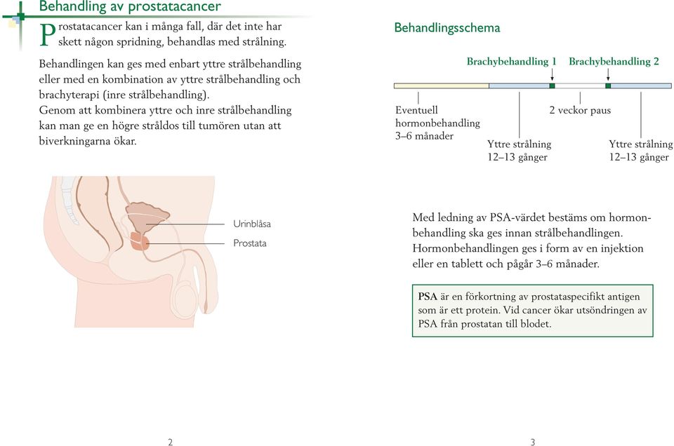 Genom att kombinera yttre och inre stråbehanding kan man ge en högre strådos ti tumören utan att biverkningarna ökar.