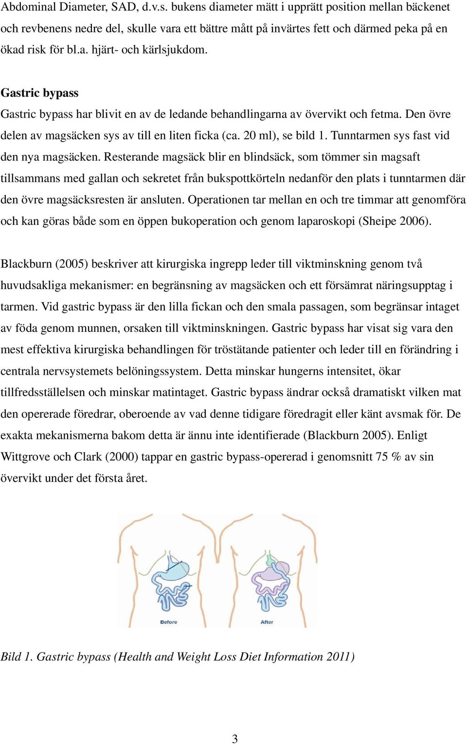 20 ml), se bild 1. Tunntarmen sys fast vid den nya magsäcken.