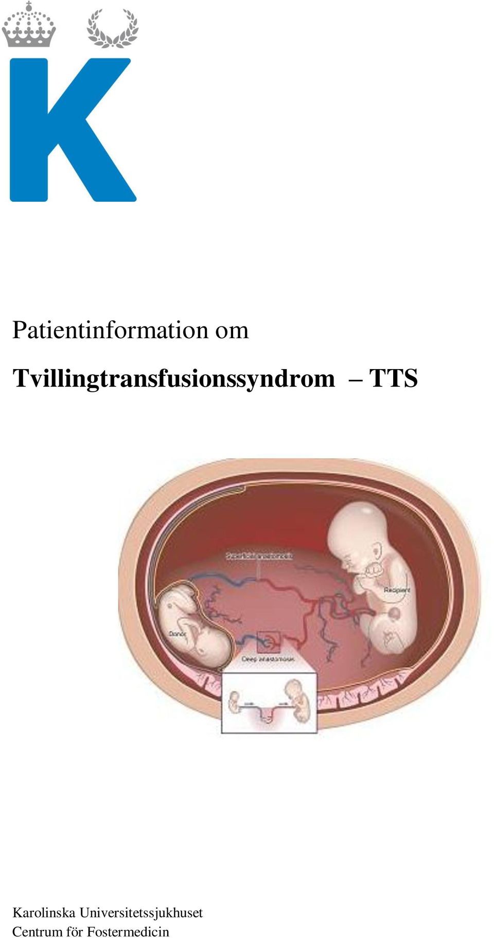 TTS Karolinska