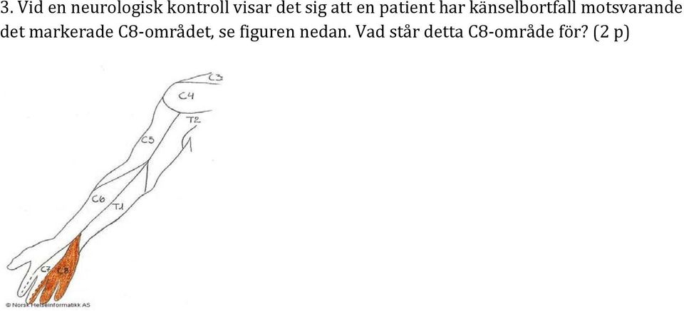 motsvarande det markerade C8-området, se