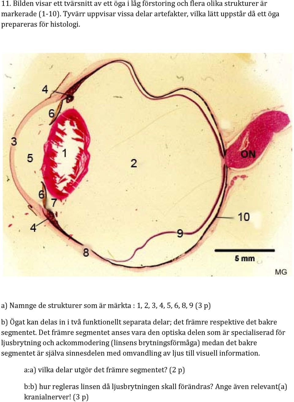 a) Namnge de strukturer som är märkta : 1, 2, 3, 4, 5, 6, 8, 9 (3 p) b) Ögat kan delas in i två funktionellt separata delar; det främre respektive det bakre segmentet.