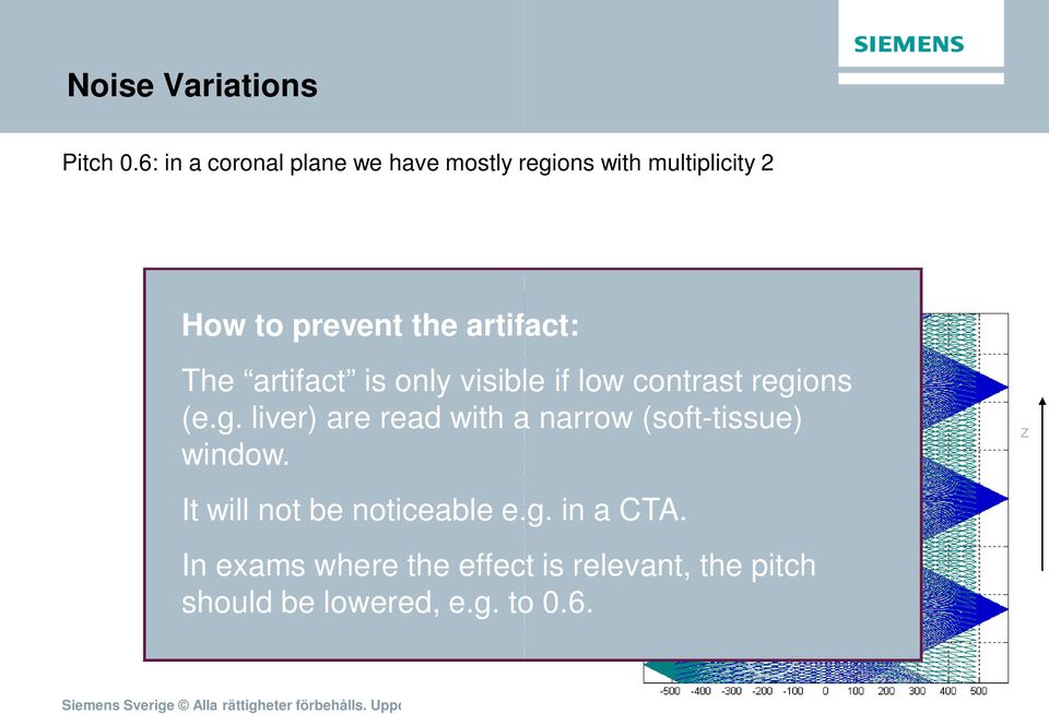 artifact: The artifact is only visible if low contrast regi