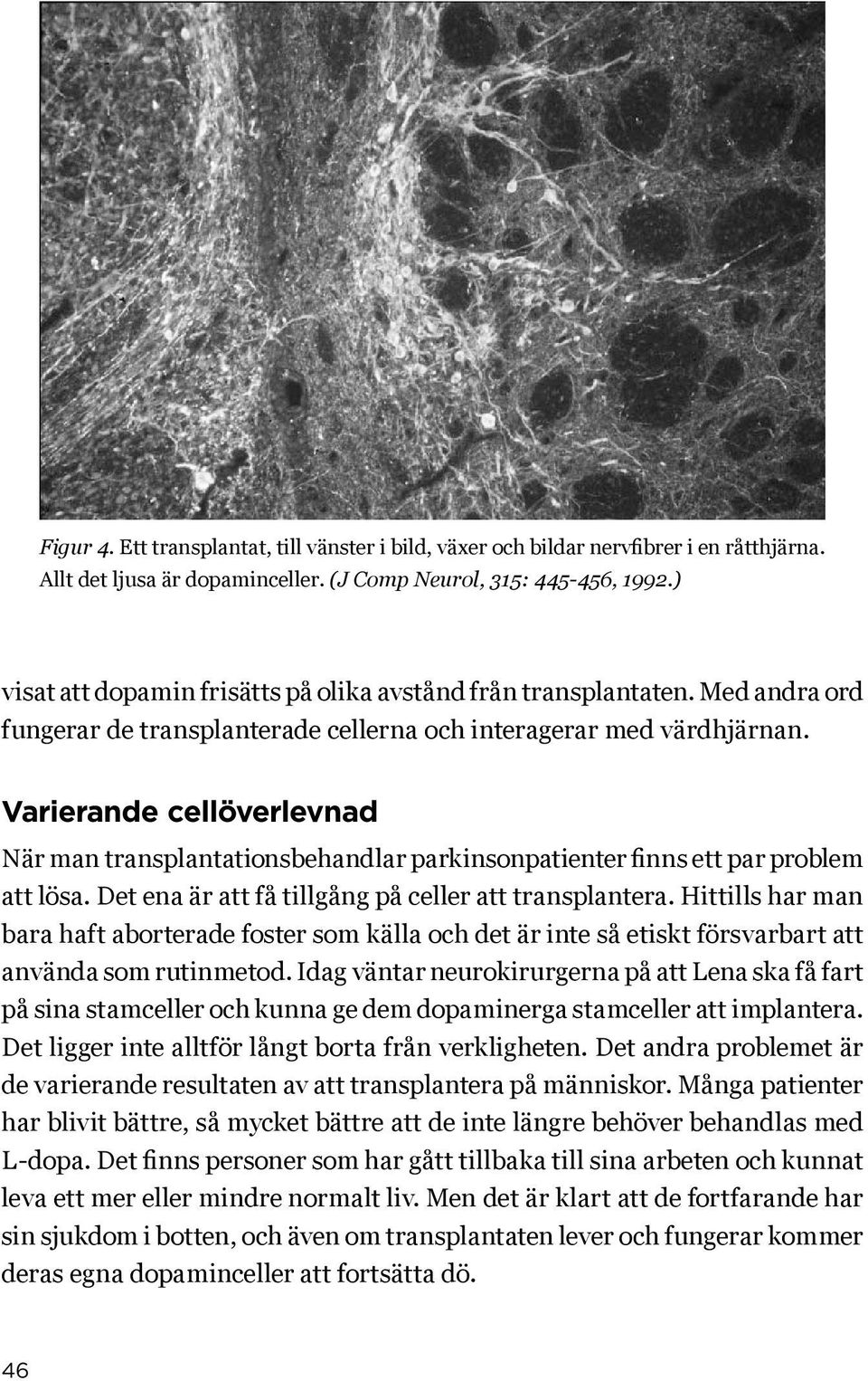 Varierande cellöverlevnad När man transplantationsbehandlar parkinsonpatienter finns ett par problem att lösa. Det ena är att få tillgång på celler att transplantera.