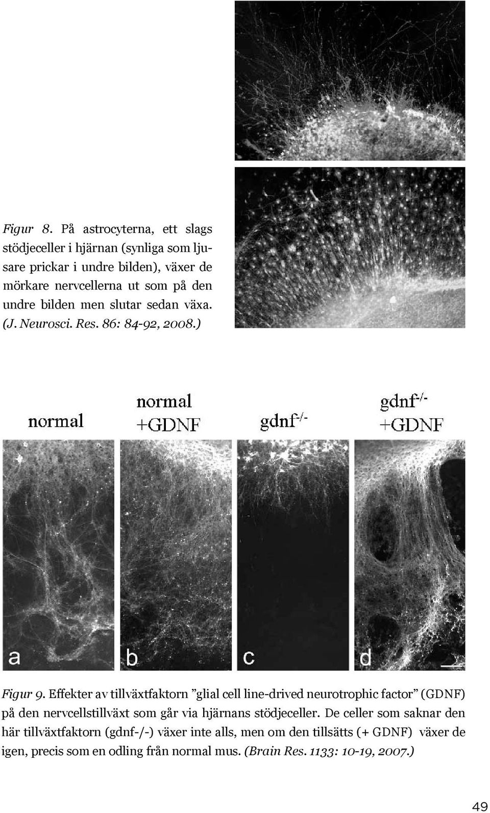 undre bilden men slutar sedan växa. (J. Neurosci. Res. 86: 84-92, 2008.) Figur 9.