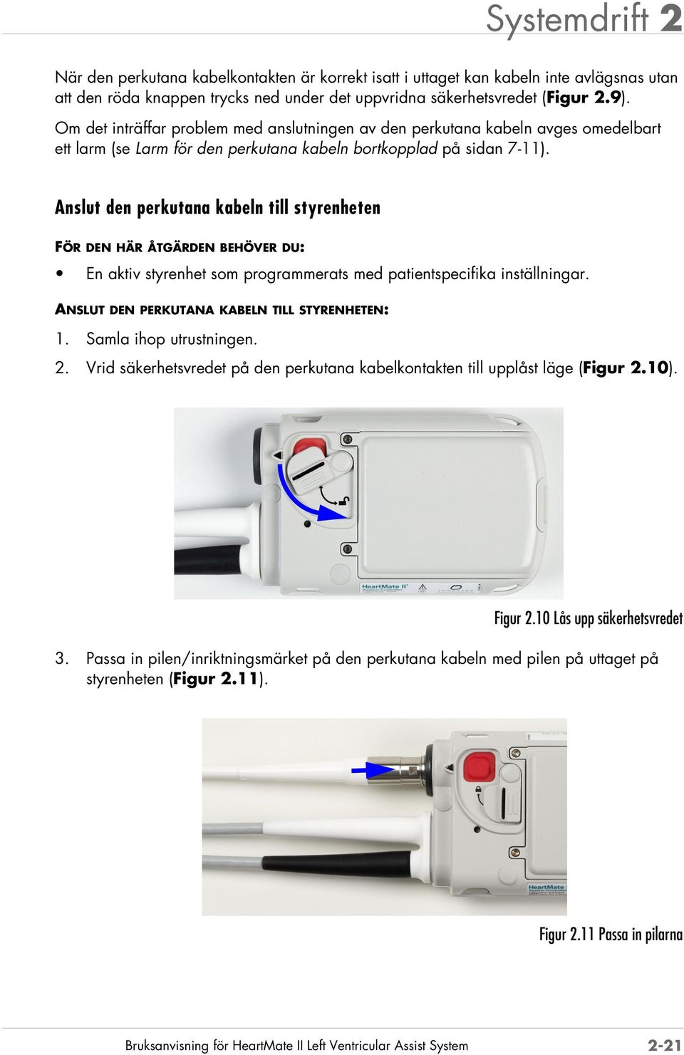 Anslut den perkutana kabeln till styrenheten FÖR DEN HÄR ÅTGÄRDEN BEHÖVER DU: En aktiv styrenhet som programmerats med patientspecifika inställningar. ANSLUT DEN PERKUTANA KABELN TILL STYRENHETEN: 1.