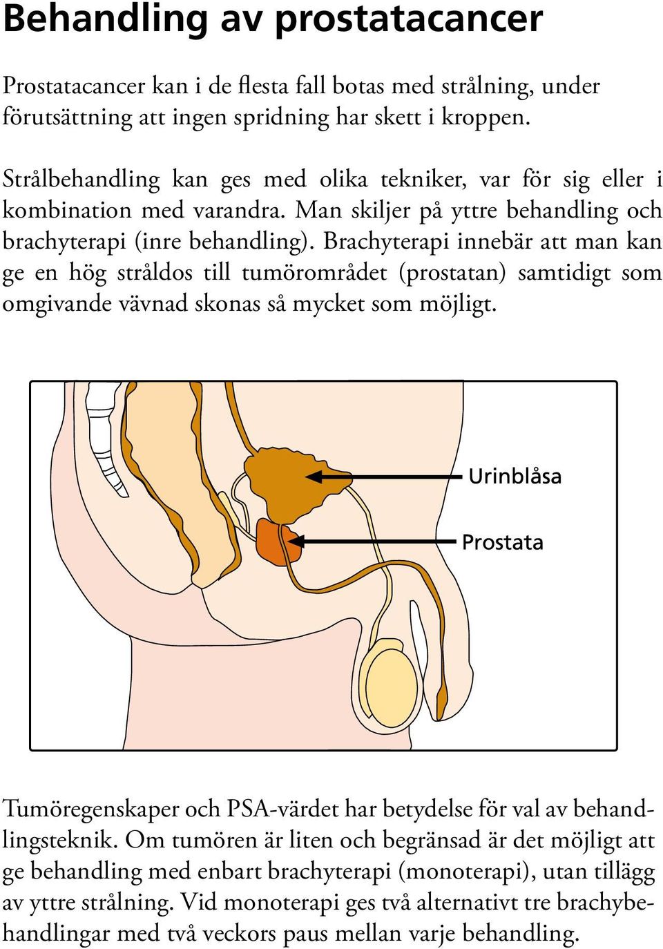 Brachyterapi innebär att man kan ge en hög stråldos till tumörområdet (prostatan) samtidigt som omgivande vävnad skonas så mycket som möjligt.