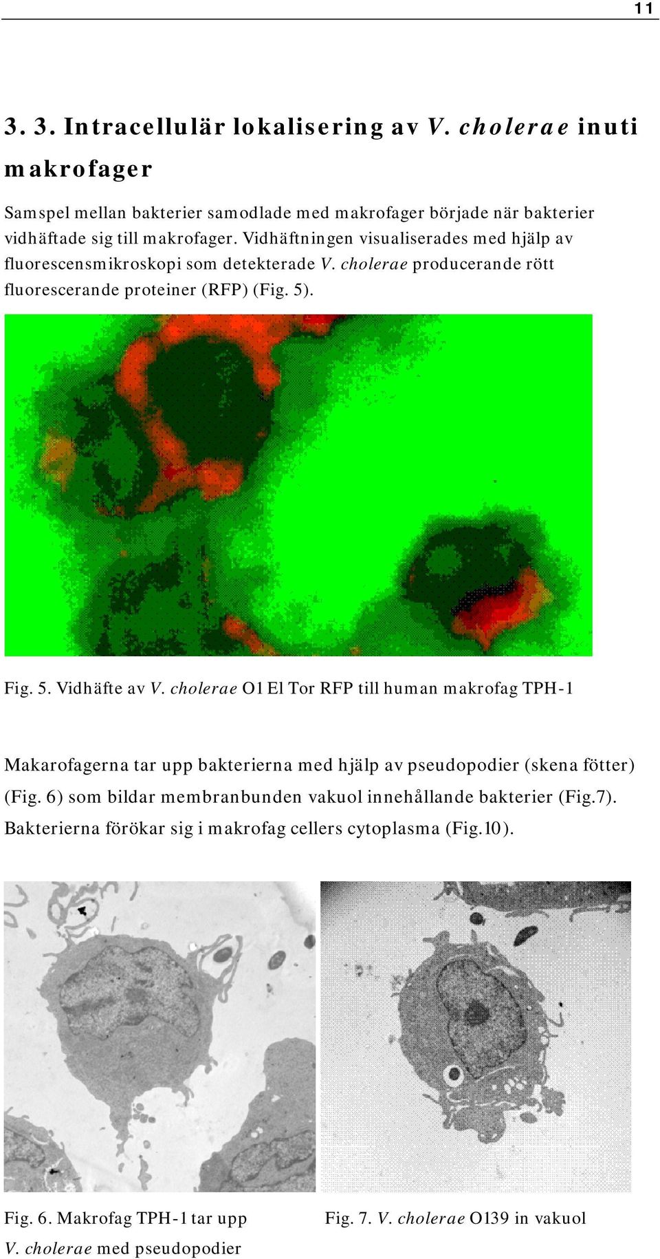 cholerae O1 El Tor RFP till human makrofag TPH-1 Makarofagerna tar upp bakterierna med hjälp av pseudopodier (skena fötter) (Fig.