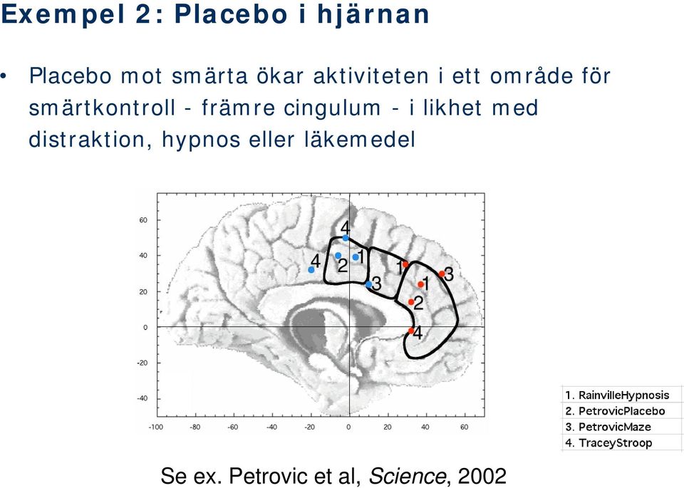 främre cingulum - i likhet med distraktion, hypnos