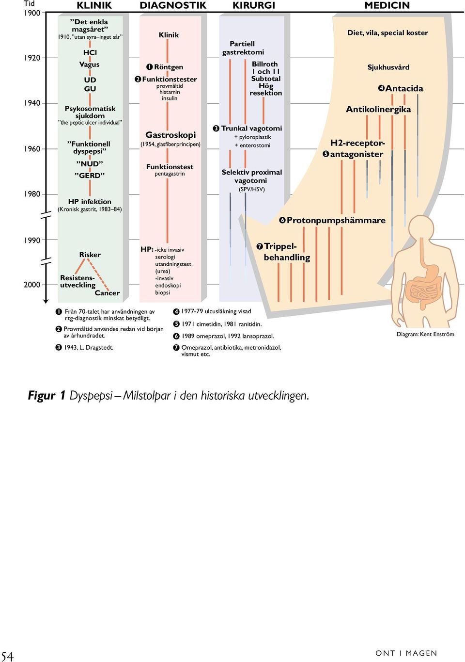 Billroth 1 och 11 Subtotal Hög resektion Trunkal vagotomi + pyloroplastik + enterostomi Selektiv proximal vagotomi (SPV/HSV) 6 5 Diet, vila, special koster Antacida Antikolinergika