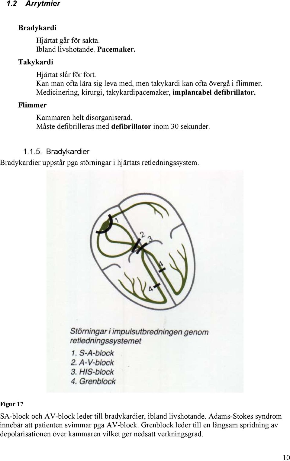 Flimmer Kammaren helt disorganiserad. Måste defibrilleras med defibrillator inom 30 sekunder. 1.1.5.