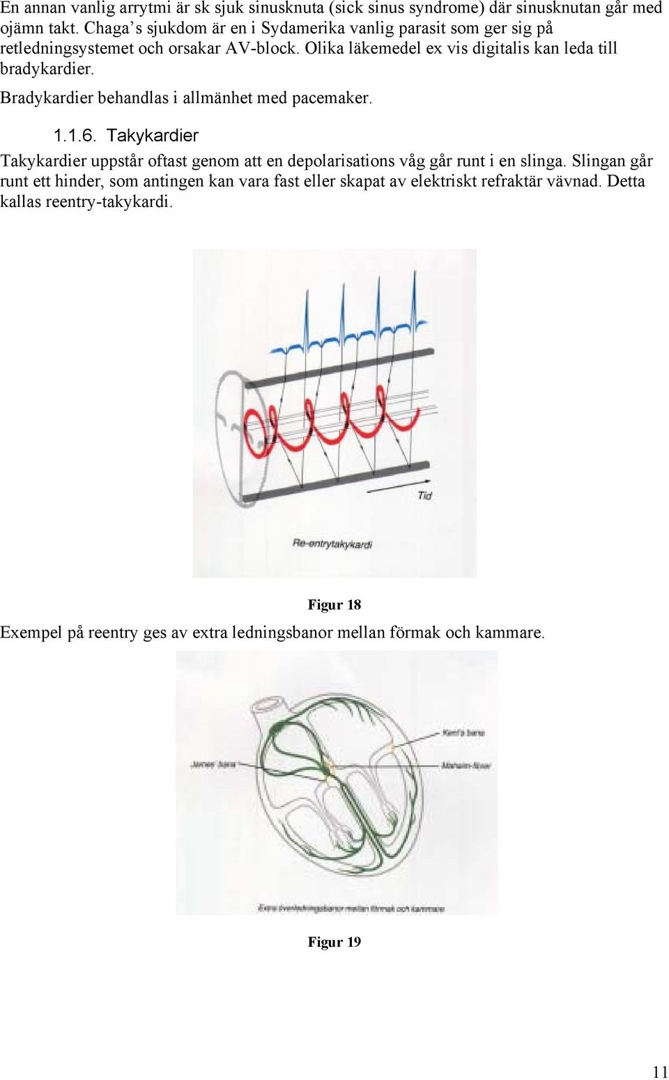 Olika läkemedel ex vis digitalis kan leda till bradykardier. Bradykardier behandlas i allmänhet med pacemaker. 1.1.6.
