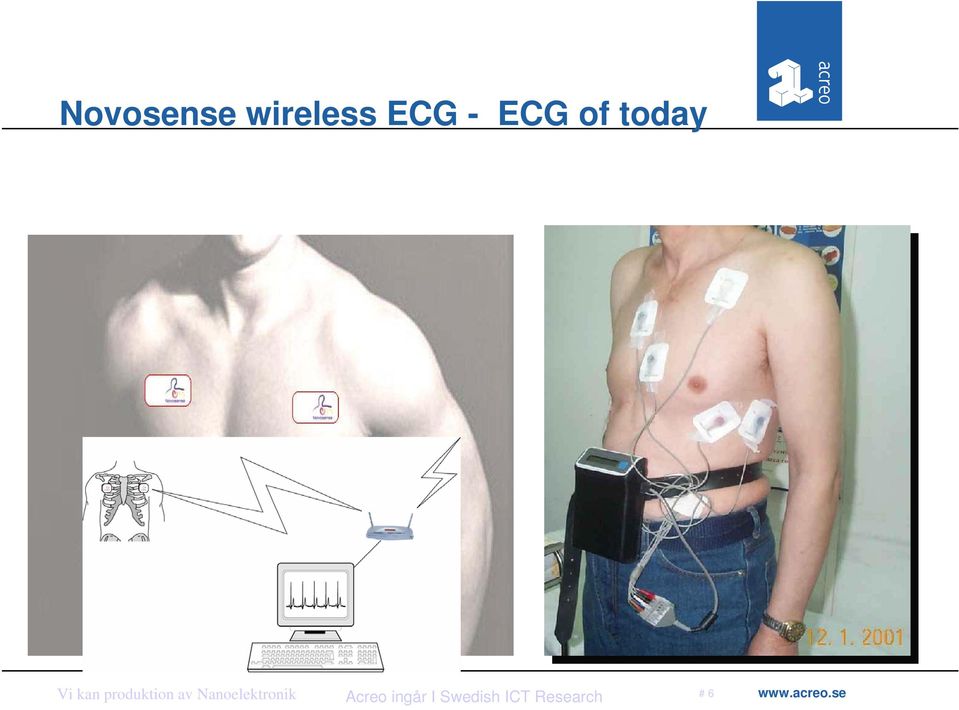 - ECG of