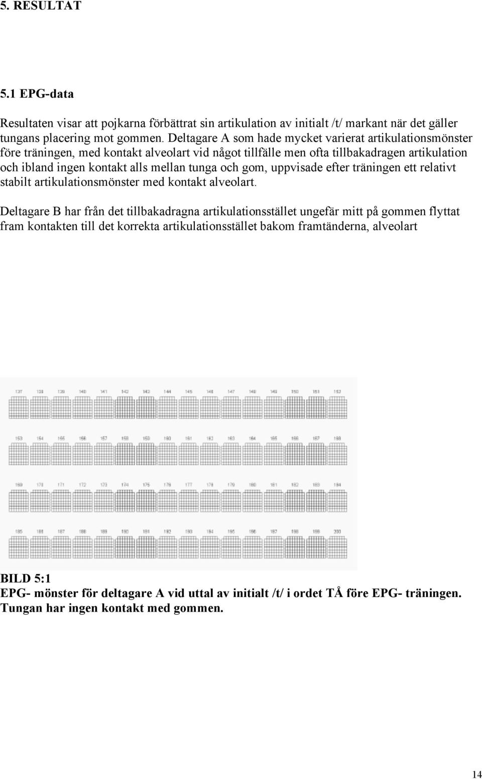 tunga och gom, uppvisade efter träningen ett relativt stabilt artikulationsmönster med kontakt alveolart.
