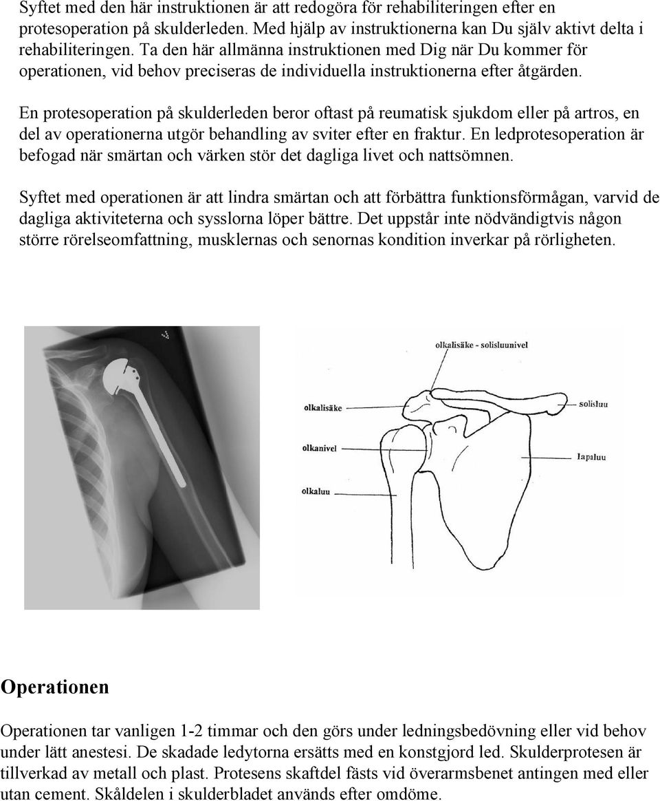 En protesoperation på skulderleden beror oftast på reumatisk sjukdom eller på artros, en del av operationerna utgör behandling av sviter efter en fraktur.