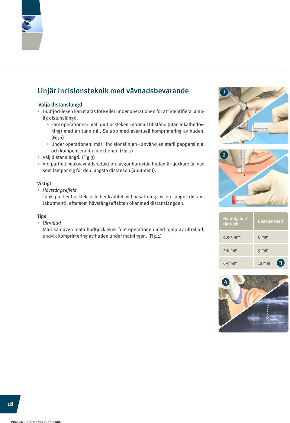 1) Under operationen: mät i incisionslinjen - använd en steril papperslinjal och kompensera för injektioner. (Fig.