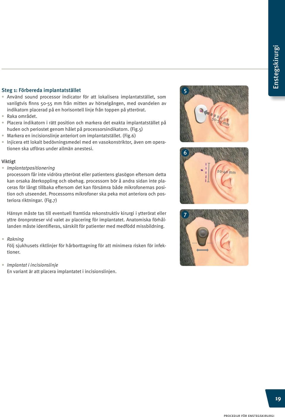 Placera indikatorn i rätt position och markera det exakta implantatstället på huden och periostet genom hålet på processorsindikatorn. (Fig.5) Markera en incisionslinje anteriort om implantatstället.