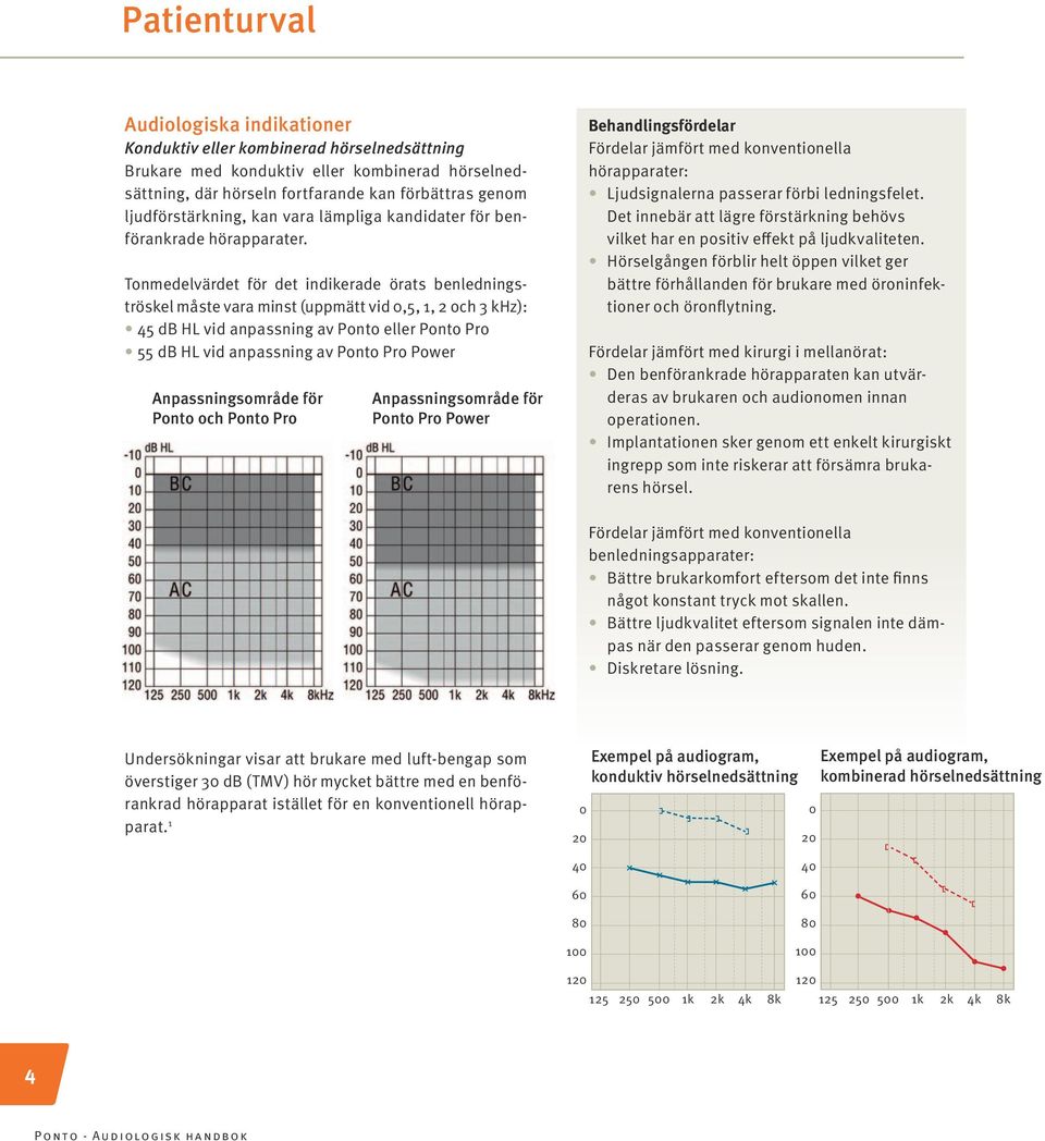 Tonmedelvärdet för det indikerade örats benledningströskel måste vara minst (uppmätt vid 0,5, 1, 2 och 3 khz): 45 db HL vid anpassning av Ponto eller Ponto Pro 55 db HL vid anpassning av Ponto Pro