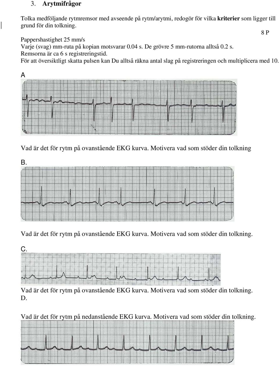 För att översiktligt skatta pulsen kan Du alltså räkna antal slag på registreringen och multiplicera med 10. A Vad är det för rytm på ovanstående EKG kurva.