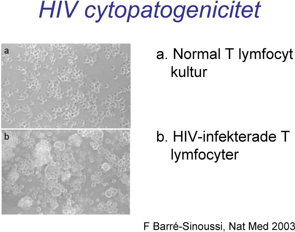 HIV-infekterade T