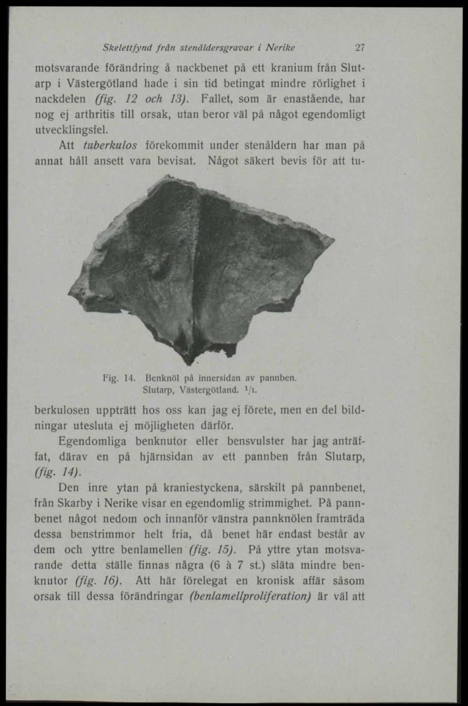 Något säkert bevis för att tu- >-, Fig. 14. Benknöl på innersidan av pannben. Slutarp, Västergötland. 1 /i.